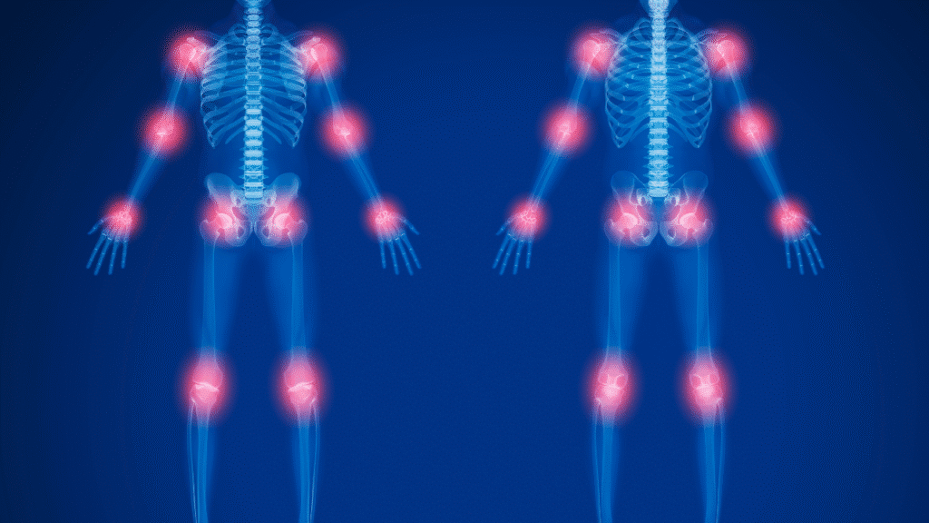 Illustration of paint points on a skeleton to showcase Conditions We Treat in Austin