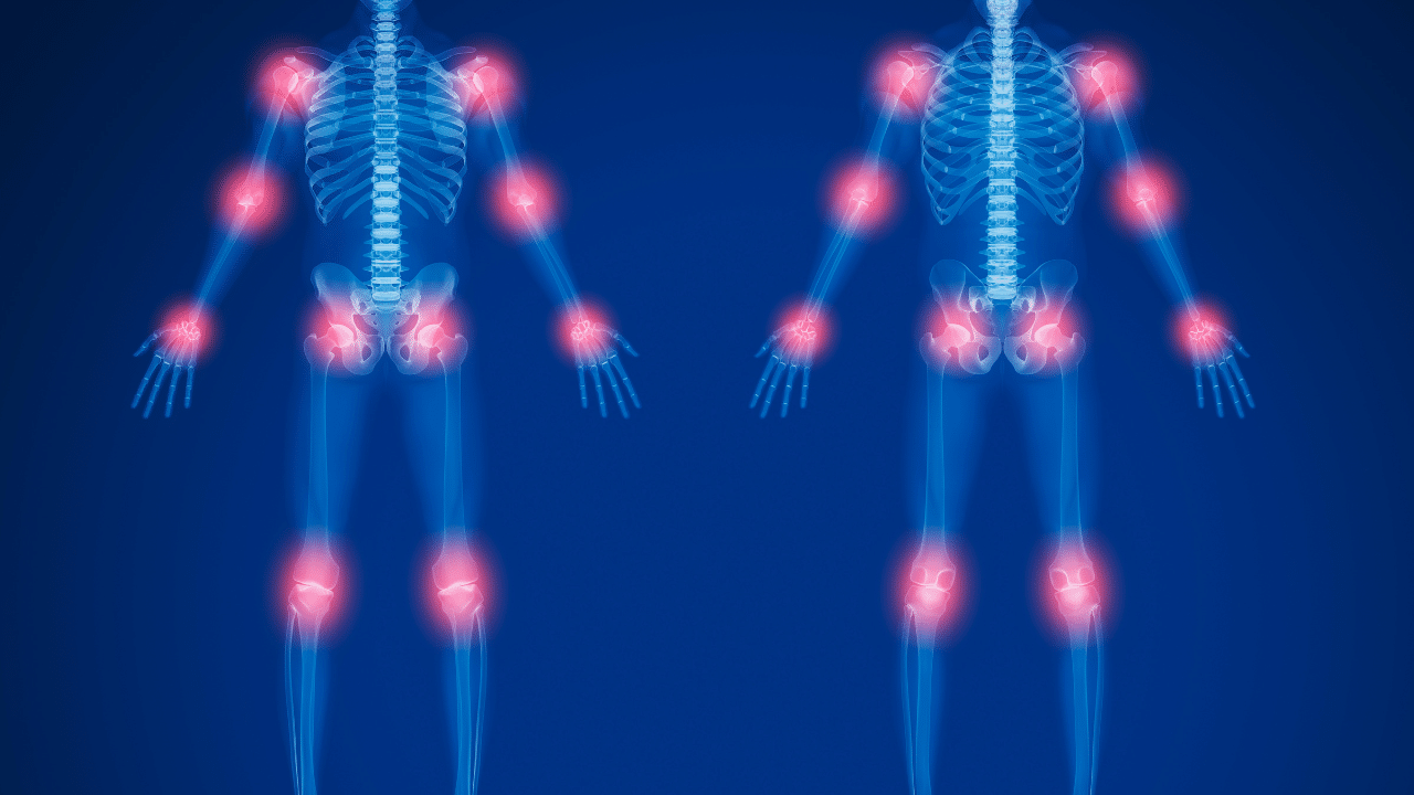 Illustration of paint points on a skeleton to showcase Conditions We Treat in Austin