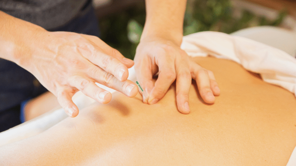 PT works on a patient while explaining Understanding the “Why” Behind Dry Needling Relief
