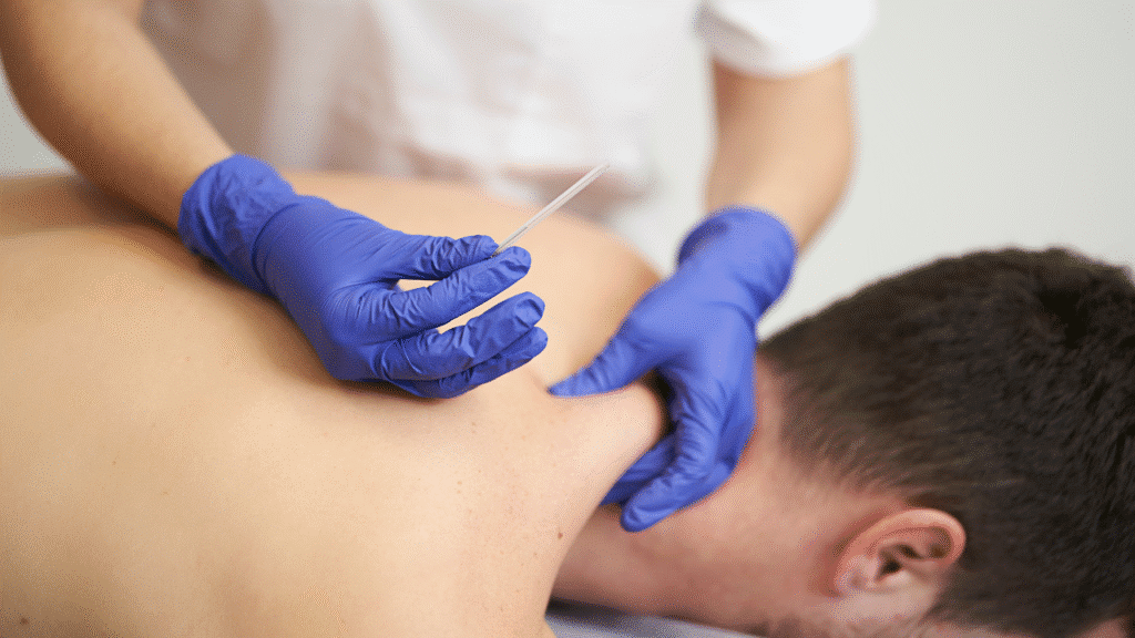 PT uses a needle on a patient's nesk as they ask: What Is Dry Needling, and How Can It Help You Feel Better Fast?