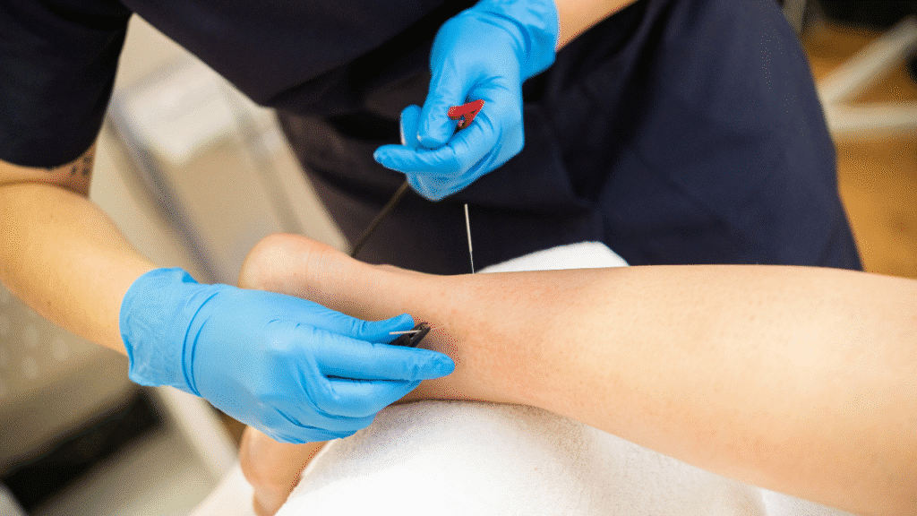 Physical therapist uses a needle on a patient's ankle as they discuss: What Is Dry Needling, and How Can It Help You Feel Better Fast?